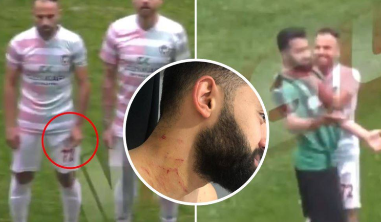 Pesepakbola Turki Serang Lawan Main dengan Silet