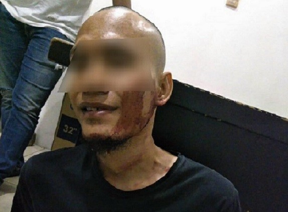 Mapolsek Penjaringan Diserang, Polisi Akui Pelakunya Bukan Teroris