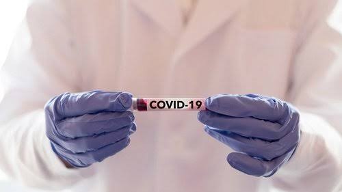 Saatnya Presiden Buat Gerakan Nasional Komando Crisis Center Virus Corona