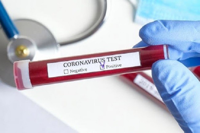 Dubes China untuk AS Ungkap Ada Kasus Positif Corona Sebelum Wuhan
