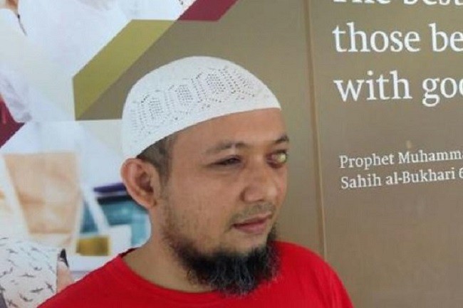 Setelah Anak-anaknya, Istri Novel Baswedan Juga Positif COVID-19