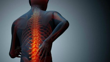 Dokter: Osteoporosis Bukan Hanya Disebabkan Kekurangan Kalsium