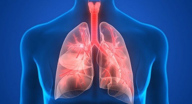 Satu dari Lima Kematian Balita di Indonesia Disebabkan oleh Pneumonia