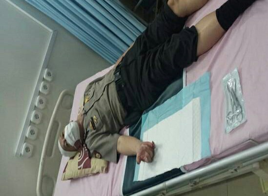 Anggota Polsek Menteng Dibacok Geng Motor, Kelingking Tangan Nyaris Putus