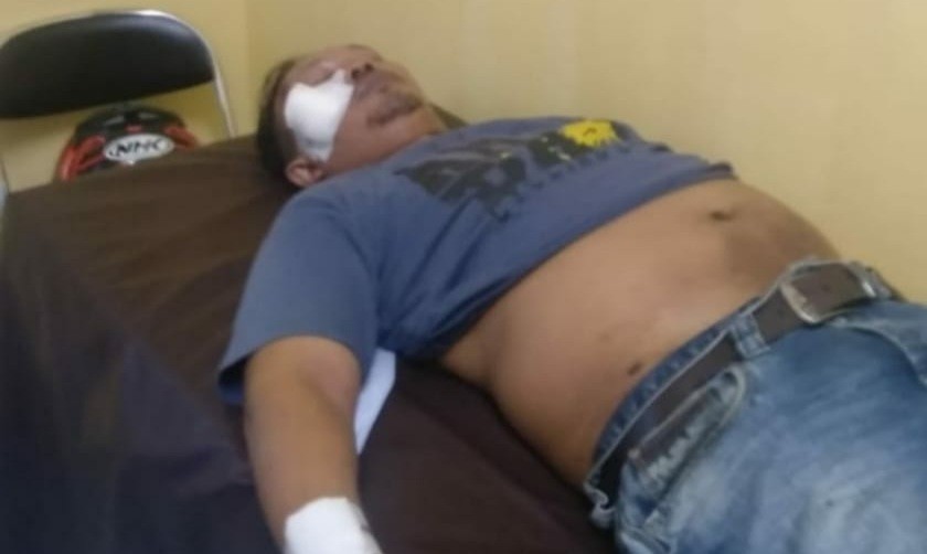 Jadi Korban Tabrak Lari, Jurnalis Senior Ini Malah Diperas Si Penabrak