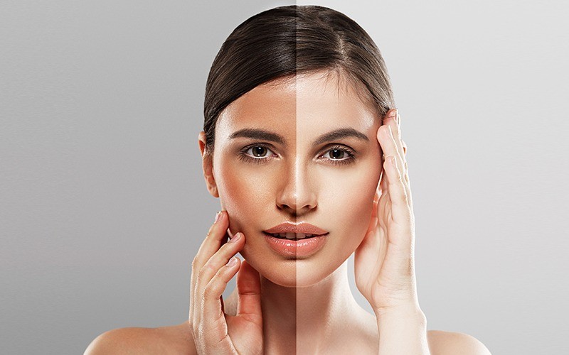 4 Tips Mengembalikan Kulit Belang Jadi Putih Secara Alami