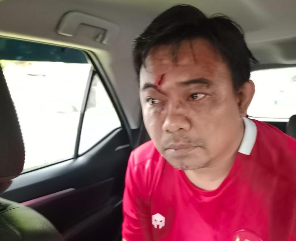 KAHMI Desak Polri Segera Usut Tuntas Pelaku Pengeroyok Ketua KNPI