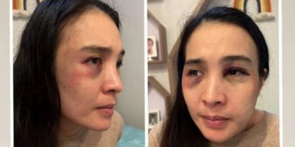Polisi Sebut Istri yang Sempat Viral di Depok Sudah Enam Kali Jadi Korban KDRT
