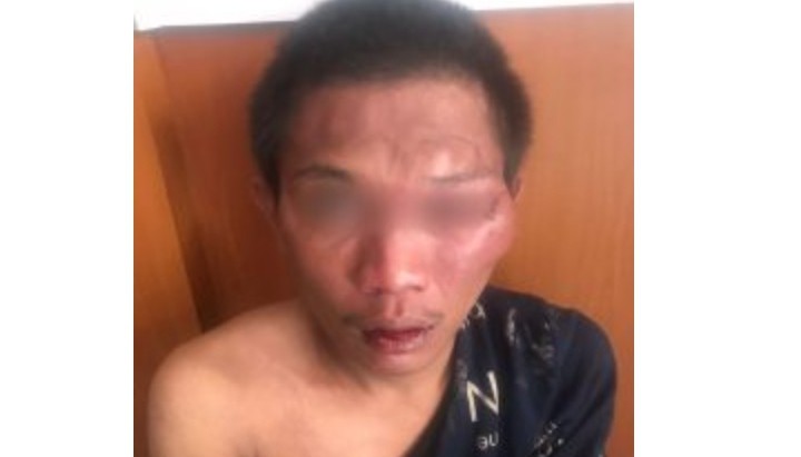 Kepergok Gondol Motor, Pemuda Ini Diamuk Massa di Palmerah