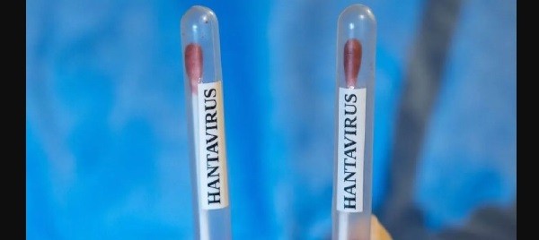 Pemerintah Diminta Waspada dalam Kasus Suspek Hantavirus 