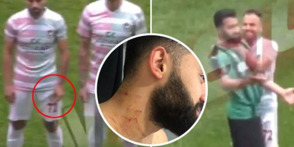 Pesepakbola Turki Serang Lawan Main dengan Silet