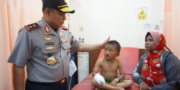 29 Pasien Ikuti Senyum Bersama Polri