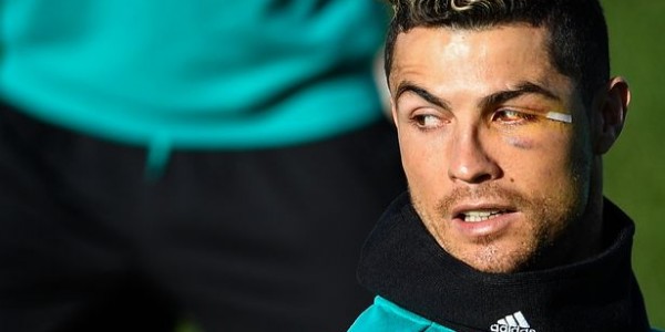 Mata Kirinya Lebam, Ronaldo Ngaku Masih Ganteng