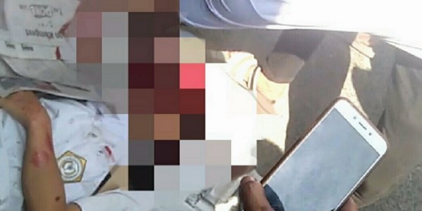 Tawuran Pelajar, Seorang Siswa SMP Tewas Ditebas Celurit di Jakarta Barat