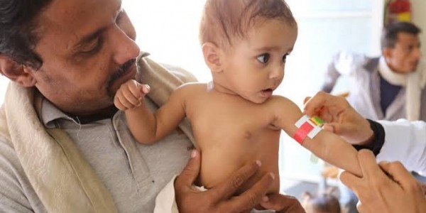 Setiap 10 Menit, Bayi di Yaman Meninggal Karena Kelaparan Akut