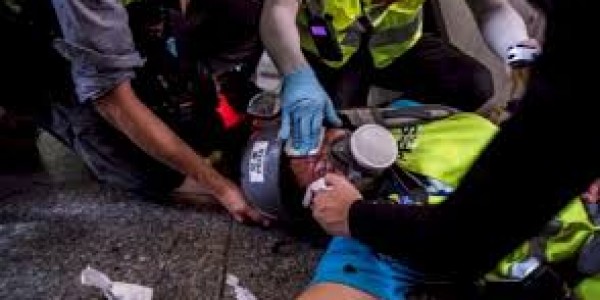 Mata Tertembak Aparat, Veby Jurnalis Asal Indonesia Tuntut Hong Kong Tanggung Jawab
