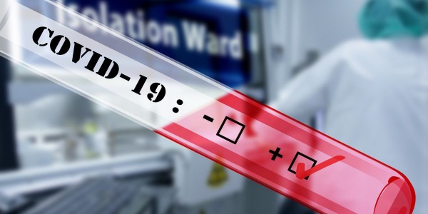 Pemerintah Harus Tingkatkan Kesiagaan Terkait Covid-19