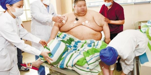Bobot Pria Ini Bertambah 100 Kg Selama Lockdown Lima Bulan