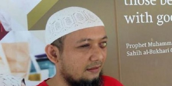 Setelah Anak-anaknya, Istri Novel Baswedan Juga Positif COVID-19