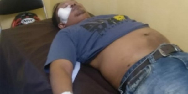 Jadi Korban Tabrak Lari, Jurnalis Senior Ini Malah Diperas Si Penabrak
