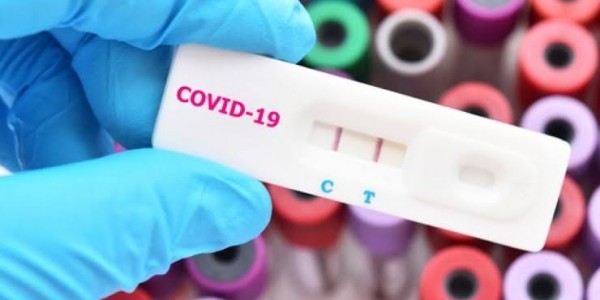 BPK Sebut Ada Kelebihan Bayar Rp1,1 Miliar untuk Alat Rapid Test Pemprov DKI