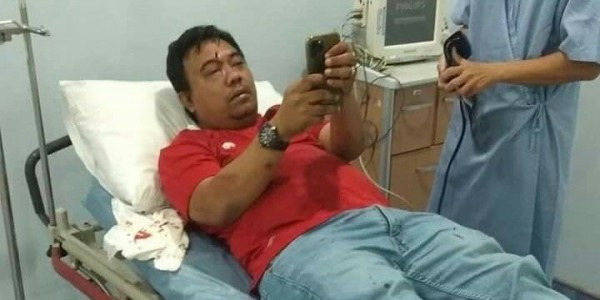 Diduga Berjumlah Tiga Orang, Polisi Buru Pelaku Pengeroyokan Ketum KNPI Haris Pratama