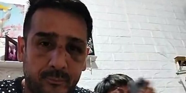 Polisi Dalami Kasus Dugaan Penganiayaan yang Menimpa Mantan Pesepak Bola Claudio Martinez