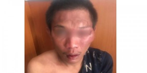 Kepergok Gondol Motor, Pemuda Ini Diamuk Massa di Palmerah