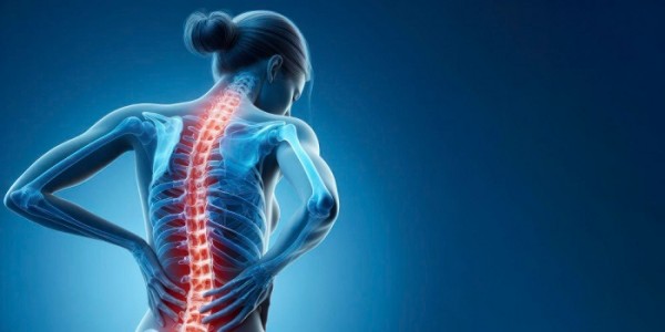 Tips Mengatasi Tulang Punggung Bongkok di Usia Muda