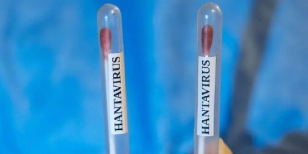 Pemerintah Diminta Waspada dalam Kasus Suspek Hantavirus 